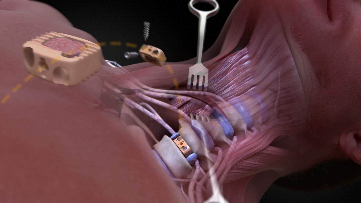 Medical Animation, Exploring the Benefits