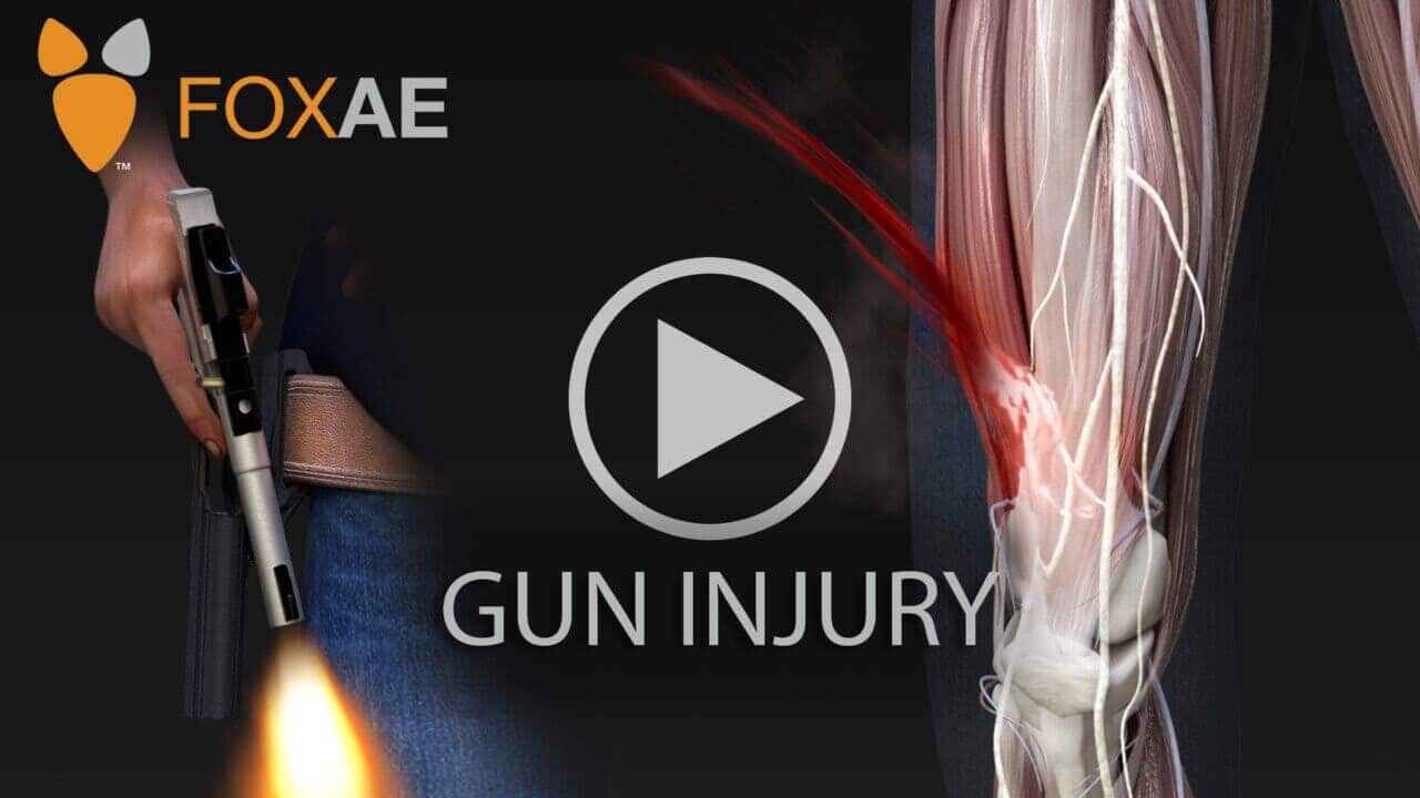 leg gun injury