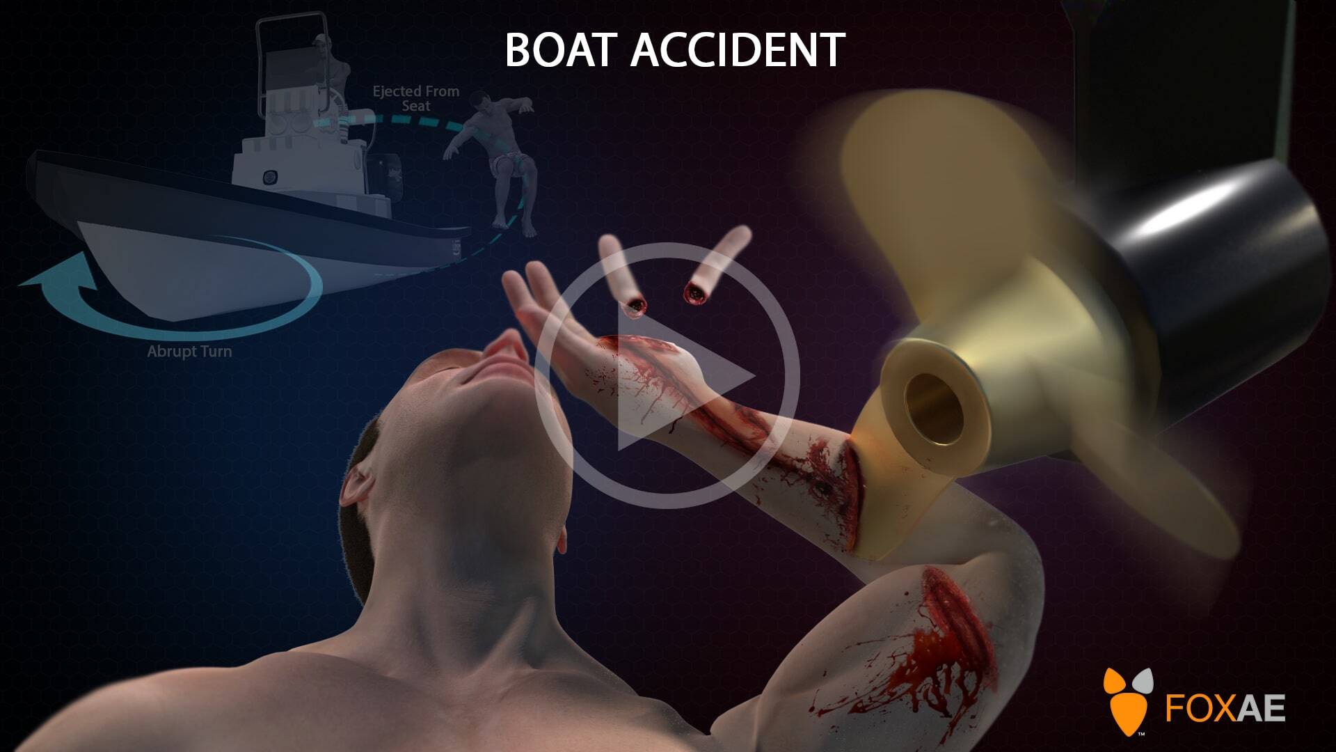 boat arm accident