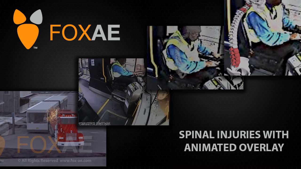 Spinal Injuries with Animated Overlay