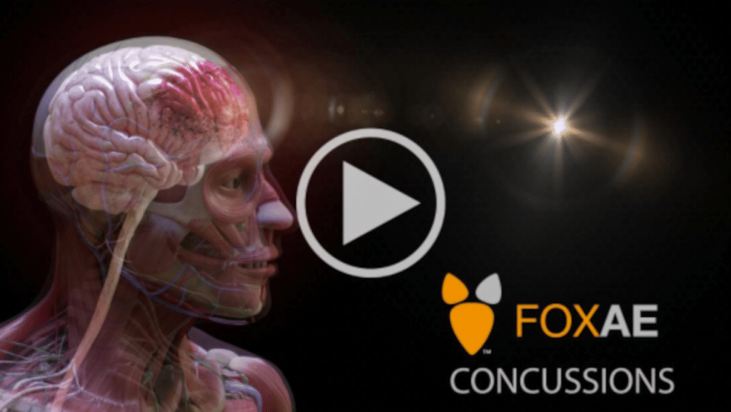 How Influential Is A Concussion Animation During Trial? | Fox-AE