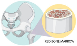 Bone Marrow Concentrate