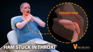 ham-stuck-in-throat
