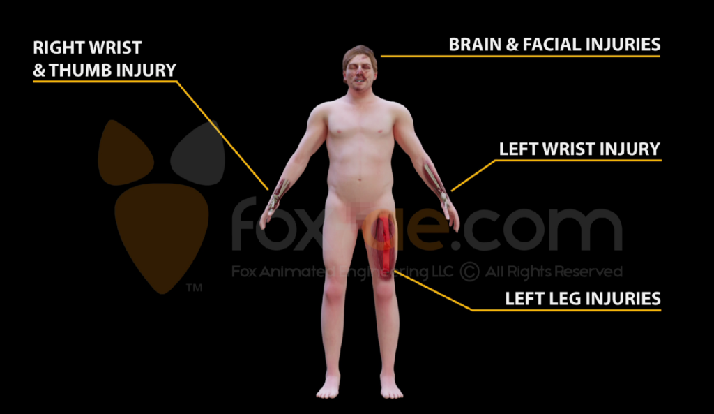 Diagram of a nude adult showing injuries: right wrist/thumb, left wrist, and left leg marked with highlighted injury areas.