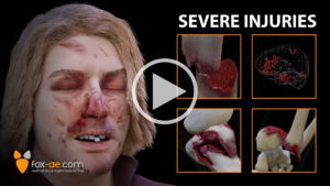Animated close-up of a person with multiple facial wounds, with a storyboard grid titled 'Severe Injuries'.