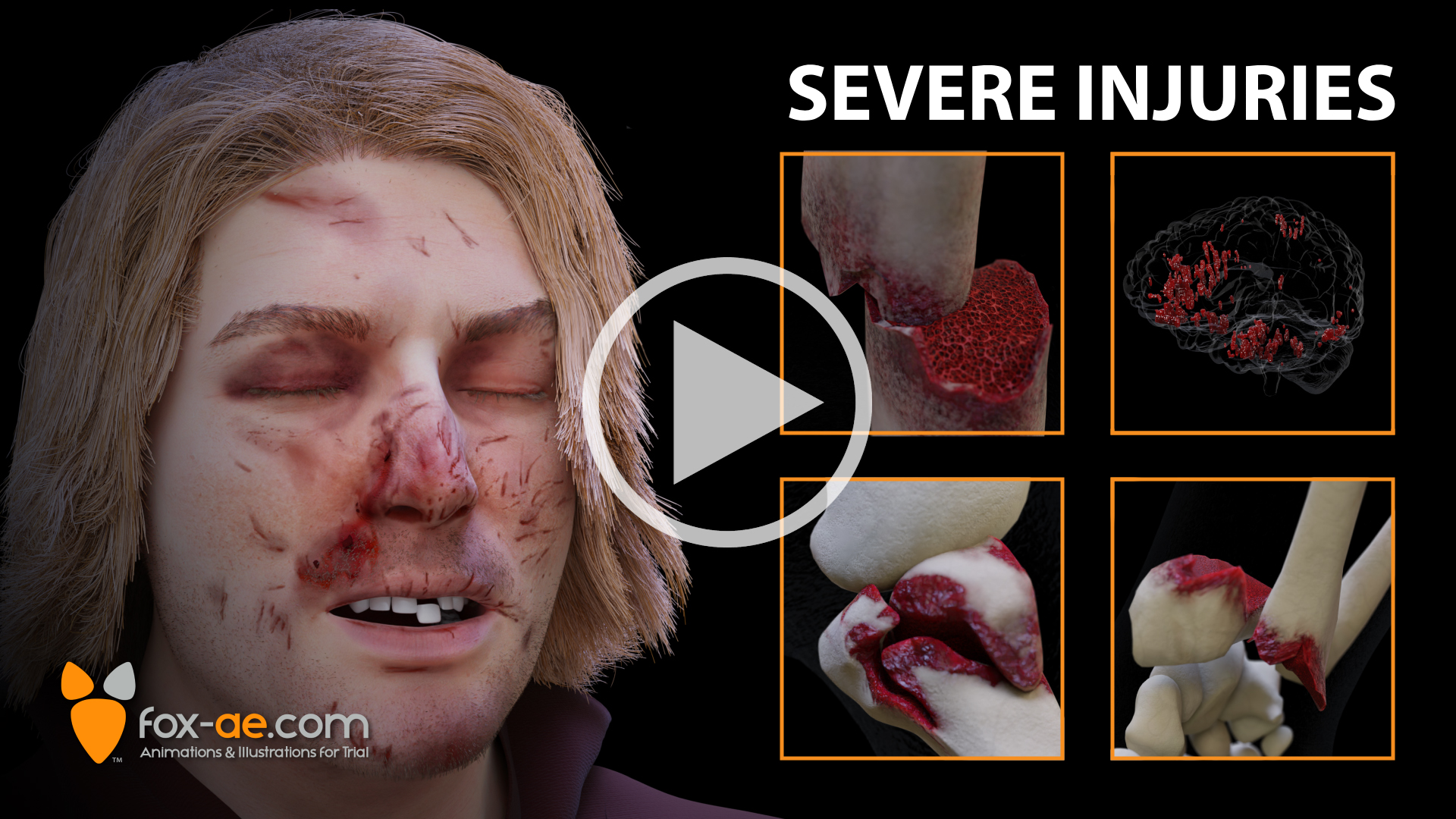 Animated close-up of a person with multiple facial wounds, with a storyboard grid titled 'Severe Injuries'.